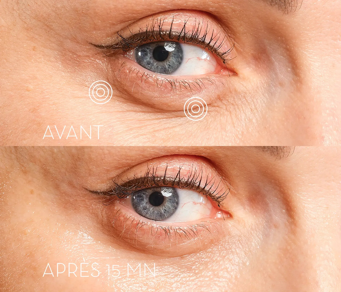 Eye Precision Mask